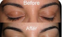 Amazing skin care tips after threading face 